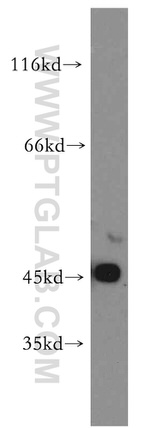 ACADS Antibody in Western Blot (WB)