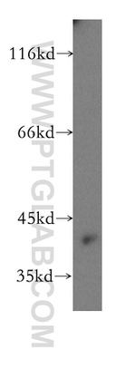 HOMER3 Antibody in Western Blot (WB)