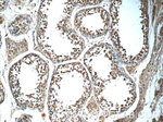 MRPL36 Antibody in Immunohistochemistry (Paraffin) (IHC (P))