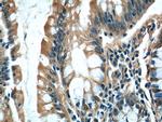 MRPL36 Antibody in Immunohistochemistry (Paraffin) (IHC (P))