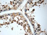MRPL36 Antibody in Immunohistochemistry (Paraffin) (IHC (P))