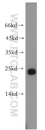 HDDC2 Antibody in Western Blot (WB)
