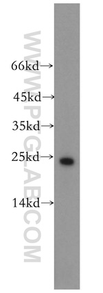 HDDC2 Antibody in Western Blot (WB)
