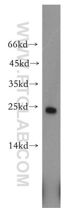 HDDC2 Antibody in Western Blot (WB)