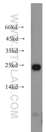 HDDC2 Antibody in Western Blot (WB)