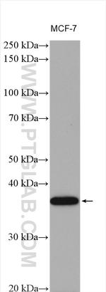 C20orf43 Antibody in Western Blot (WB)