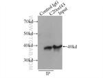 C20orf43 Antibody in Immunoprecipitation (IP)