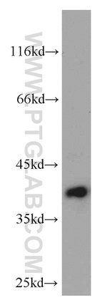 C20orf43 Antibody in Western Blot (WB)