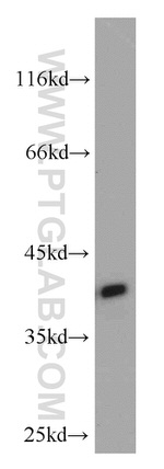 C20orf43 Antibody in Western Blot (WB)