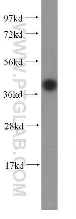 C20orf43 Antibody in Western Blot (WB)