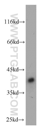 C20orf43 Antibody in Western Blot (WB)