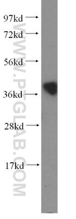 C20orf43 Antibody in Western Blot (WB)