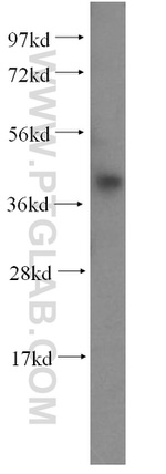 C20orf43 Antibody in Western Blot (WB)
