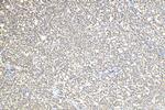 OCIAD1 Antibody in Immunohistochemistry (Paraffin) (IHC (P))