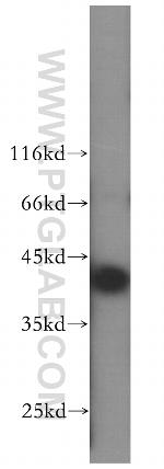 SEPHS1 Antibody in Western Blot (WB)