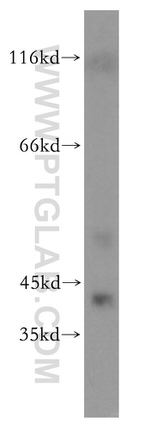 SEPHS1 Antibody in Western Blot (WB)