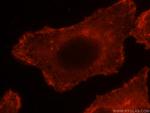 EPLIN Antibody in Immunocytochemistry (ICC/IF)