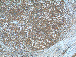 TIMP1 Antibody in Immunohistochemistry (Paraffin) (IHC (P))