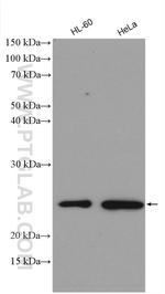 TIMP1 Antibody in Western Blot (WB)