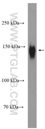 CD163 Antibody in Western Blot (WB)