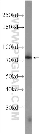 ZER1 Antibody in Western Blot (WB)