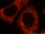 RPL28 Antibody in Immunocytochemistry (ICC/IF)