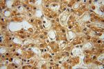 MRPL10 Antibody in Immunohistochemistry (Paraffin) (IHC (P))
