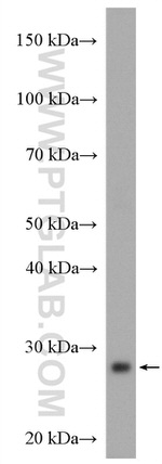 COQ4 Antibody in Western Blot (WB)