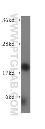 SPATA19 Antibody in Western Blot (WB)
