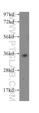 PRPS1L1 Antibody in Western Blot (WB)