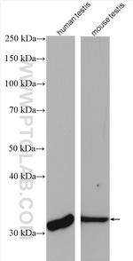 PRPS1L1 Antibody in Western Blot (WB)