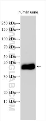 DNase I Antibody in Western Blot (WB)