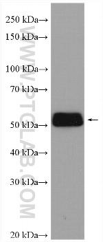UGT2B7 Antibody in Western Blot (WB)