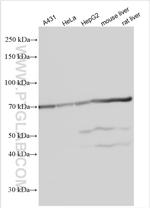 UGT1A9 Antibody in Western Blot (WB)