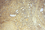 AMZ2 Antibody in Immunohistochemistry (Paraffin) (IHC (P))