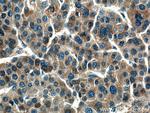 Haptoglobin Antibody in Immunohistochemistry (Paraffin) (IHC (P))