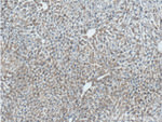 Haptoglobin Antibody in Immunohistochemistry (Paraffin) (IHC (P))