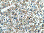 Haptoglobin Antibody in Immunohistochemistry (Paraffin) (IHC (P))