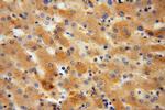 Haptoglobin Antibody in Immunohistochemistry (Paraffin) (IHC (P))