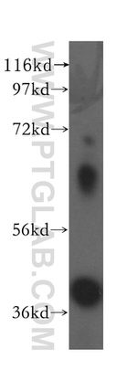 Haptoglobin Antibody in Western Blot (WB)