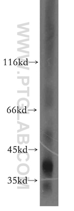 Haptoglobin Antibody in Western Blot (WB)