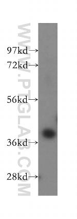 Haptoglobin Antibody in Western Blot (WB)