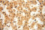 GTDC1 Antibody in Immunohistochemistry (Paraffin) (IHC (P))