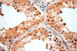 GTDC1 Antibody in Immunohistochemistry (Paraffin) (IHC (P))