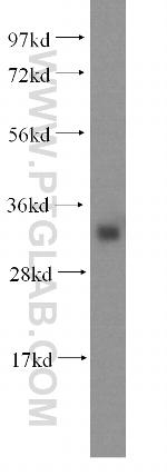 IYD Antibody in Western Blot (WB)