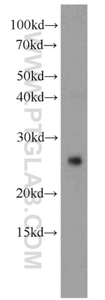 CD3 delta Antibody in Western Blot (WB)