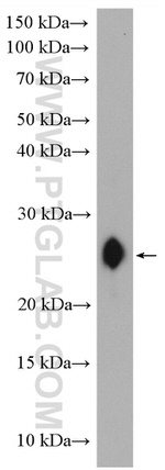 CD3 delta Antibody in Western Blot (WB)