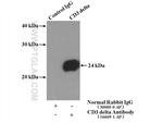 CD3 delta Antibody in Immunoprecipitation (IP)