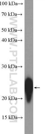 CD3 delta Antibody in Western Blot (WB)