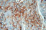 HPSE Antibody in Immunohistochemistry (Paraffin) (IHC (P))